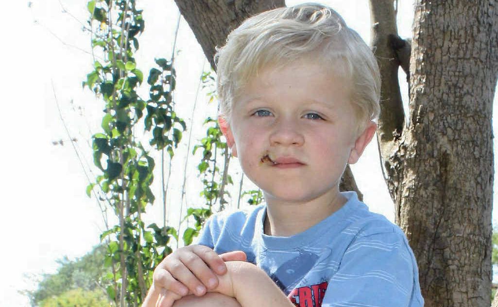 Ajay Fischer was lucky to escape serious injury after a dog bit his face. Ajay Fischer was lucky to escape serious injury after a dog bit his face.